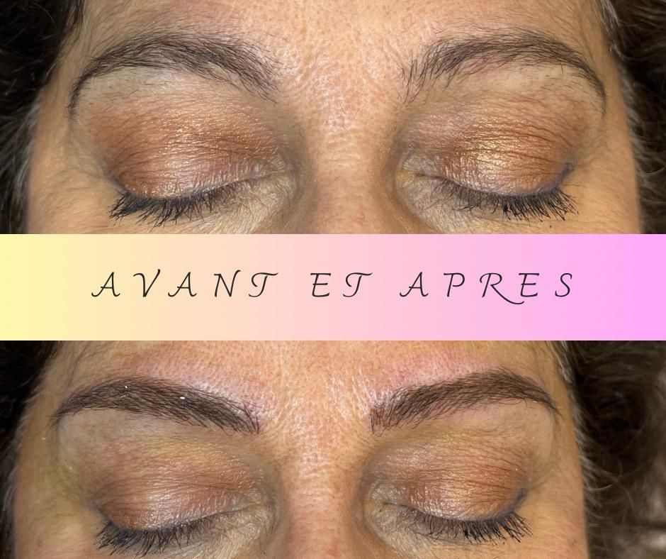 Photo d'illustration 3 sur 37