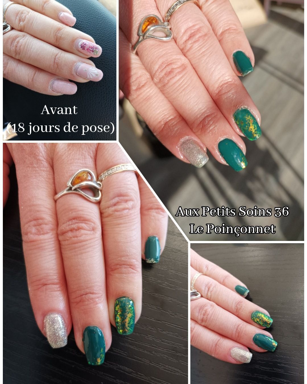 Photo d'illustration 2 sur 17