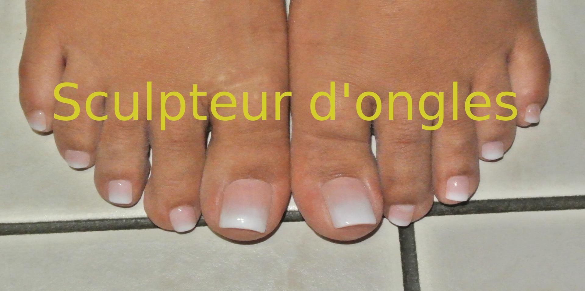 Photo d'illustration 2 sur 5