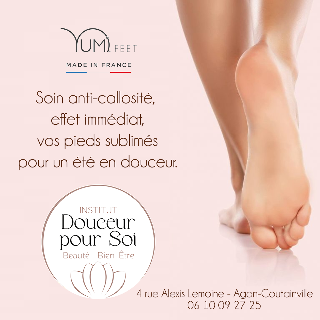Photo d'illustration 2 sur 4