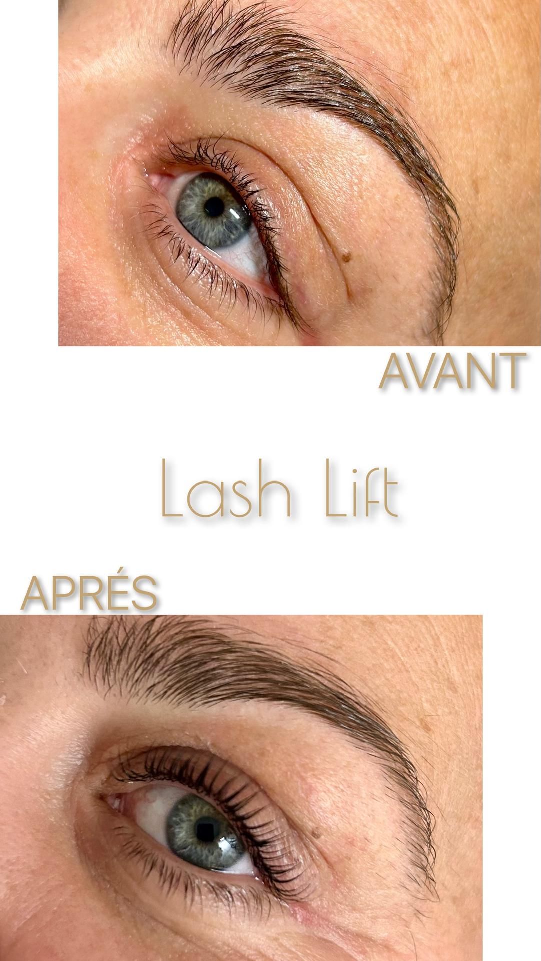 Photo d'illustration 4 sur 4