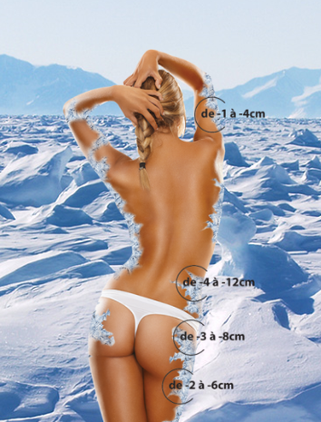 Photo d'illustration 4 sur 8