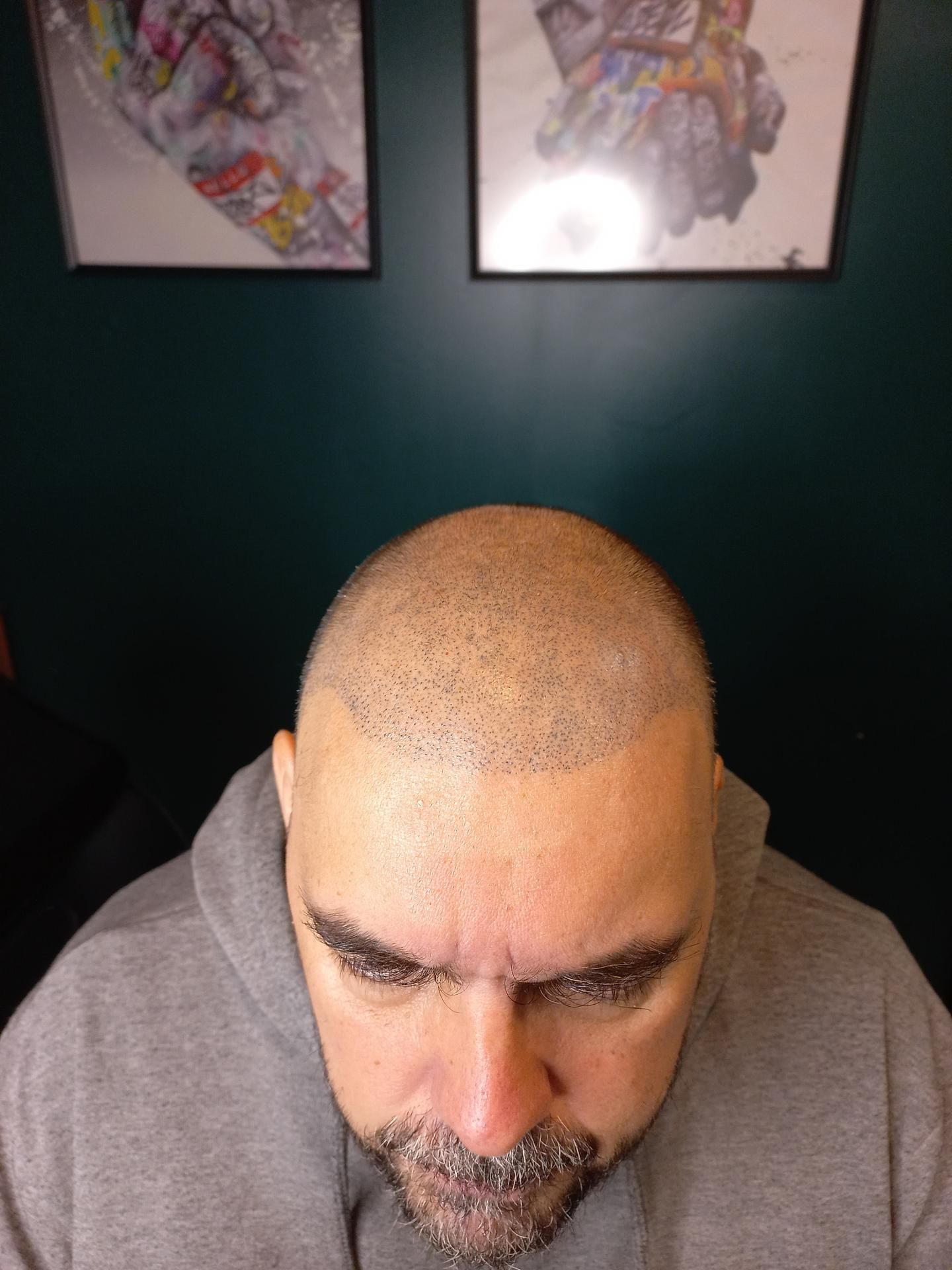 Photo d'illustration 3 sur 12