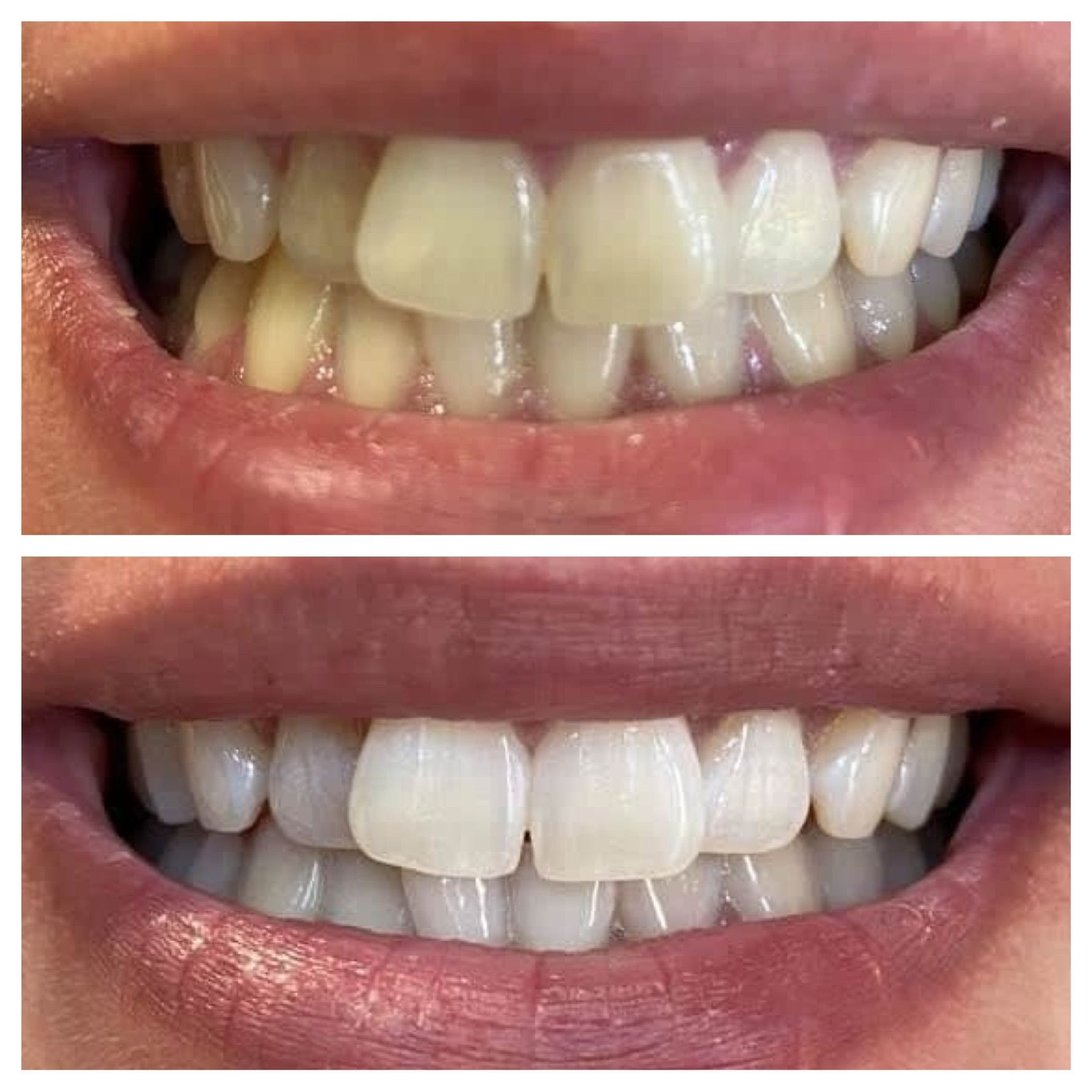 Photo d'illustration 4 sur 7