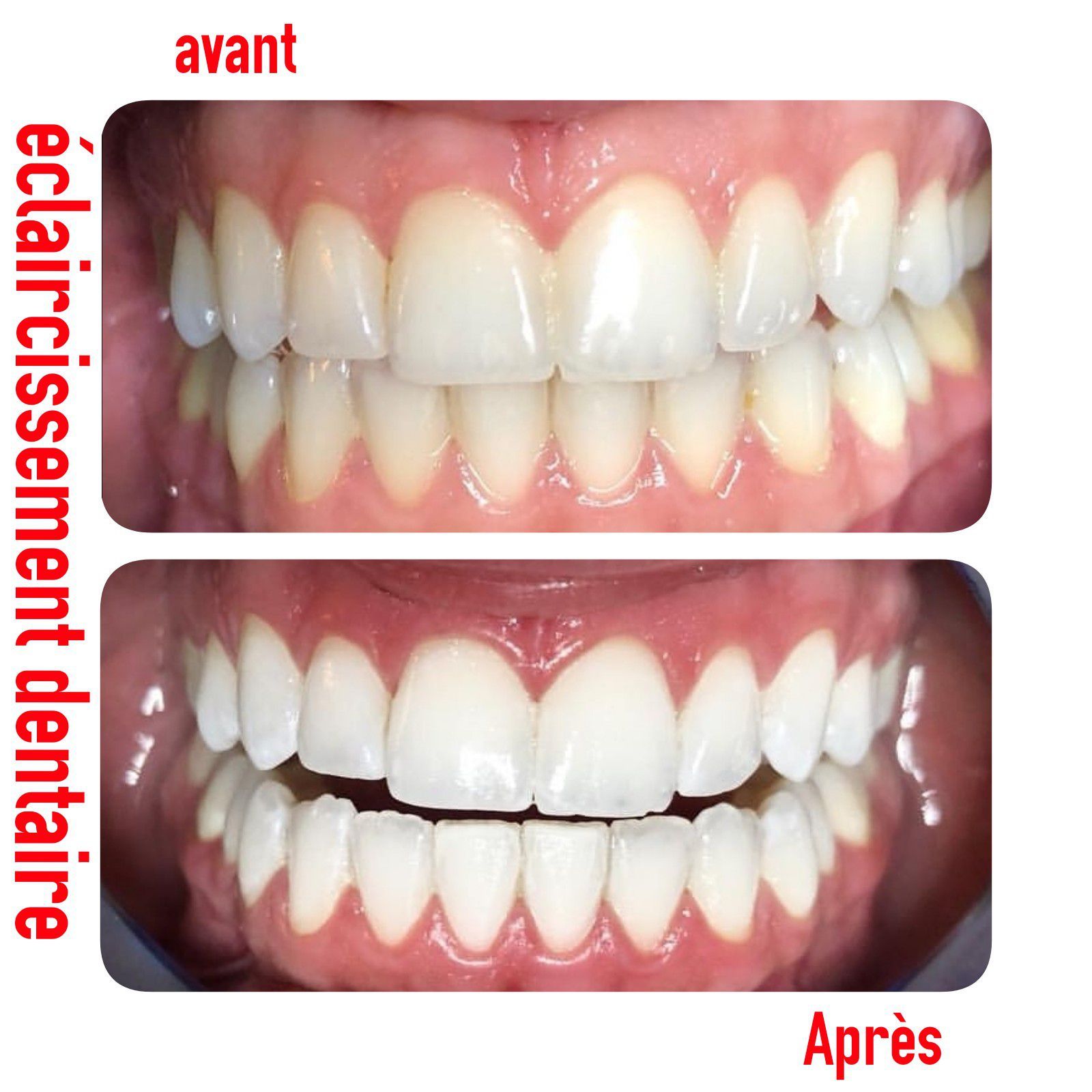 Photo d'illustration 4 sur 14