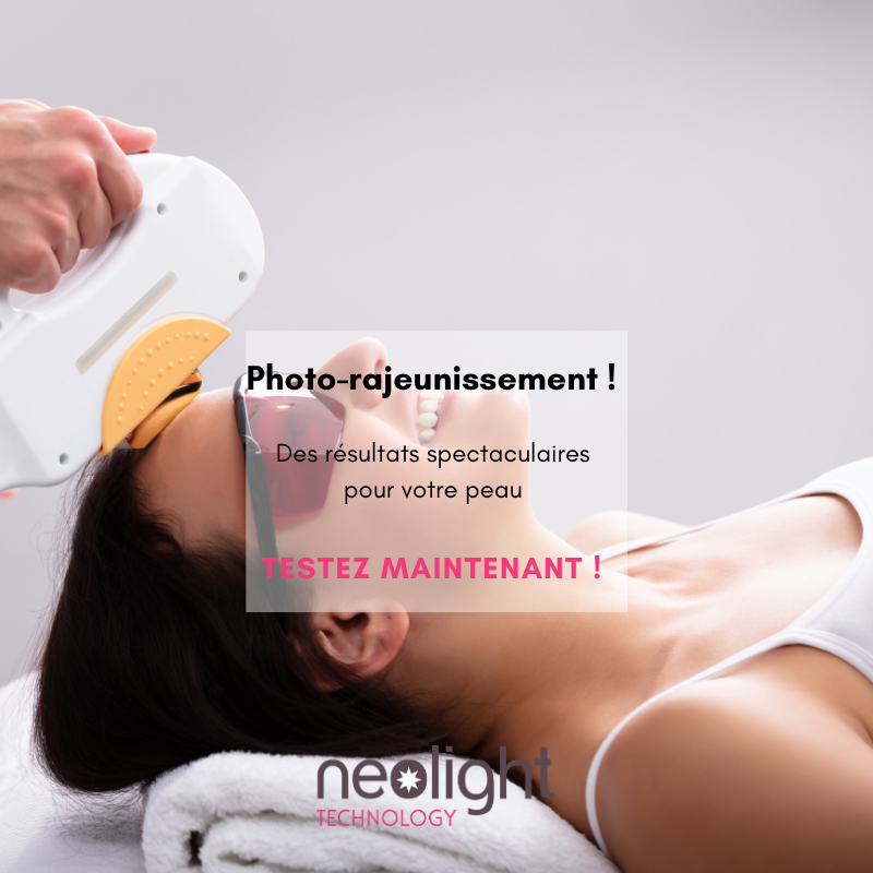 Photo d'illustration 2 sur 14