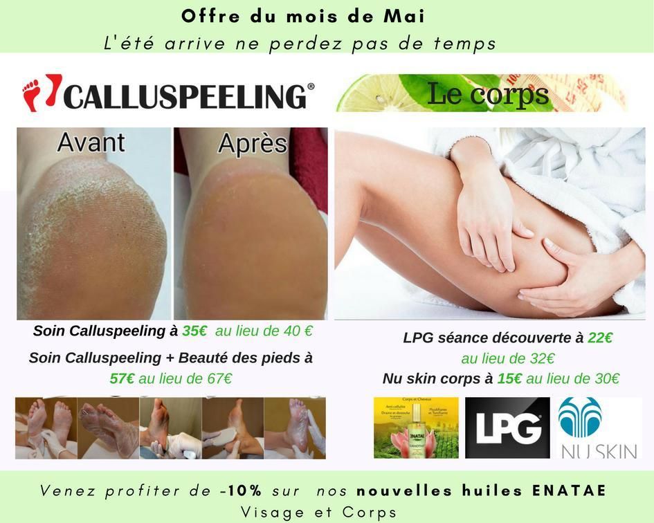 Photo d'illustration 4 sur 61
