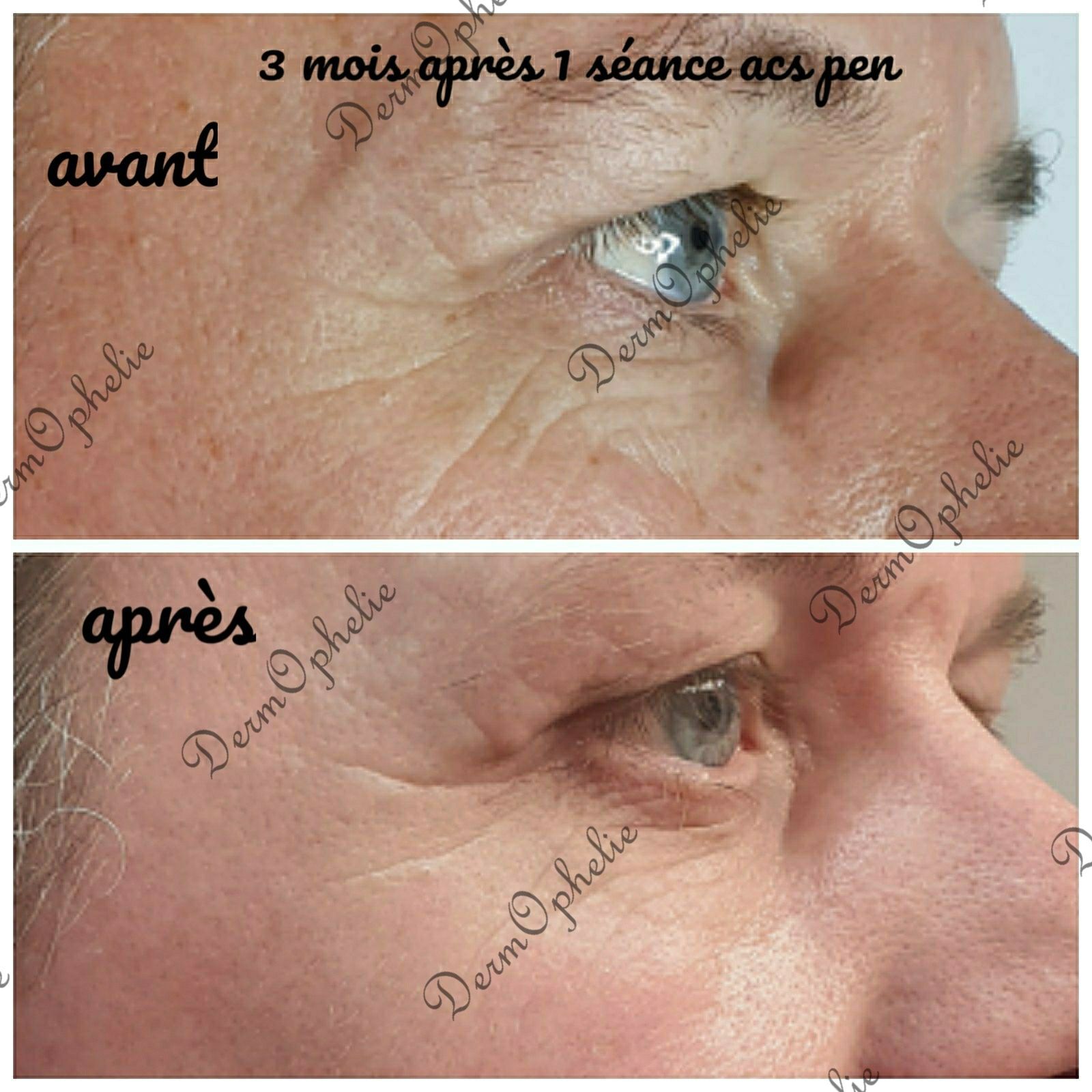 Photo d'illustration 4 sur 10